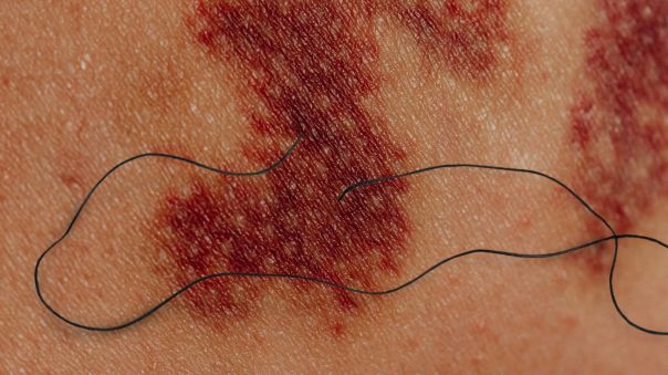 Arnaud Beaujeu lit les Proses écorchées de Béatrice&nbsp;Bonhomme